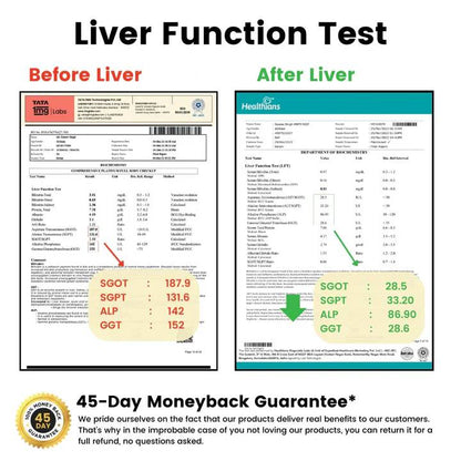 Liver Detox | Made 7+ Natural Herbs for All Liver Problems